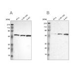GPKOW Antibody in Western Blot (WB)