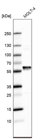 FARSA Antibody in Western Blot (WB)