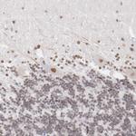 TFAP4 Antibody in Immunohistochemistry (Paraffin) (IHC (P))