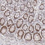 TFAP4 Antibody in Immunohistochemistry (Paraffin) (IHC (P))
