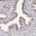 TFAP4 Antibody in Immunohistochemistry (Paraffin) (IHC (P))