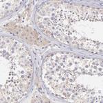 SH2D4A Antibody in Immunohistochemistry (IHC)