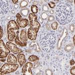 SH2D4A Antibody in Immunohistochemistry (IHC)