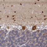 RAP1GAP Polyclonal Antibody