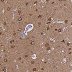 RAP1GAP Antibody in Immunohistochemistry (Paraffin) (IHC (P))