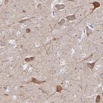 RAP1GAP Antibody in Immunohistochemistry (Paraffin) (IHC (P))