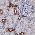 RAP1GAP Antibody in Immunohistochemistry (Paraffin) (IHC (P))