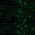 RAP1GAP Antibody in Immunohistochemistry (Paraffin) (IHC (P))