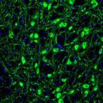 RAP1GAP Antibody in Immunohistochemistry (Paraffin) (IHC (P))