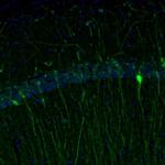 RAP1GAP Antibody in Immunohistochemistry (Paraffin) (IHC (P))