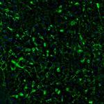 RAP1GAP Antibody in Immunohistochemistry (Paraffin) (IHC (P))