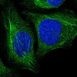 TAGLN2 Polyclonal Antibody