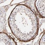 Fibulin 2 Antibody in Immunohistochemistry (Paraffin) (IHC (P))