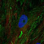 Fibulin 2 Antibody in Immunocytochemistry (ICC/IF)