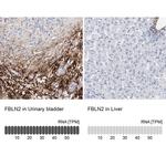 Fibulin 2 Antibody in Immunohistochemistry (IHC)
