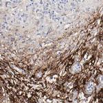 Fibulin 2 Antibody in Immunohistochemistry (IHC)