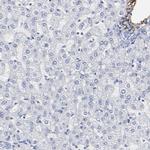 Fibulin 2 Antibody in Immunohistochemistry (IHC)