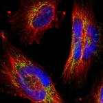 PPFIBP2 Polyclonal Antibody