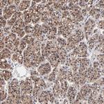 PPFIBP2 Antibody in Immunohistochemistry (Paraffin) (IHC (P))