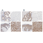 PPFIBP2 Antibody in Immunohistochemistry (Paraffin) (IHC (P))