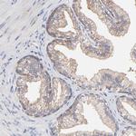 PPFIBP2 Antibody in Immunohistochemistry (Paraffin) (IHC (P))