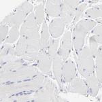 PPFIBP2 Antibody in Immunohistochemistry (Paraffin) (IHC (P))