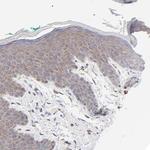 PPFIBP2 Antibody in Immunohistochemistry (Paraffin) (IHC (P))