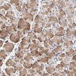 PPFIBP2 Antibody in Immunohistochemistry (Paraffin) (IHC (P))