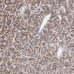 PPFIBP2 Antibody in Immunohistochemistry (IHC)