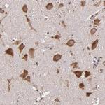 USP51 Antibody in Immunohistochemistry (Paraffin) (IHC (P))