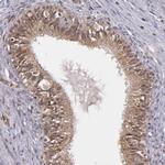 USP51 Antibody in Immunohistochemistry (Paraffin) (IHC (P))