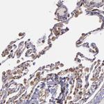USP51 Antibody in Immunohistochemistry (Paraffin) (IHC (P))