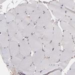 USP51 Antibody in Immunohistochemistry (Paraffin) (IHC (P))