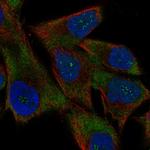 USP51 Polyclonal Antibody