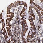 IDH3G Antibody in Immunohistochemistry (IHC)