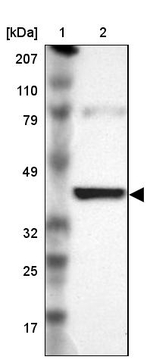 IDH3G Antibody in Western Blot (WB)