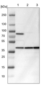 IDH3G Antibody in Western Blot (WB)