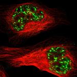 MBD4 Polyclonal Antibody