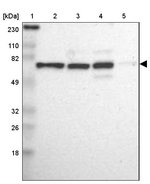 MBD4 Antibody in Western Blot (WB)