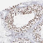 IGF2BP3 Polyclonal Antibody