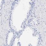 CTRP6 Antibody in Immunohistochemistry (IHC)