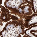 CTRP6 Antibody in Immunohistochemistry (IHC)