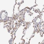 TAPP1 Antibody in Immunohistochemistry (Paraffin) (IHC (P))