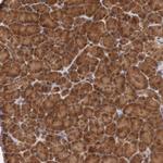 TAPP1 Antibody in Immunohistochemistry (Paraffin) (IHC (P))