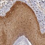 TAPP1 Antibody in Immunohistochemistry (Paraffin) (IHC (P))