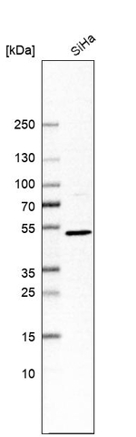 TAPP1 Antibody in Western Blot (WB)