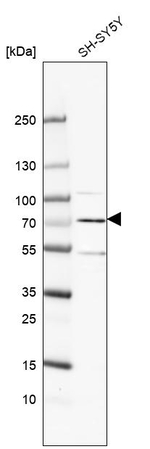 ARHGAP36 Antibody in Western Blot (WB)