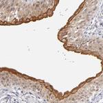 PCNXL4 Polyclonal Antibody