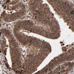 NXF2 Antibody in Immunohistochemistry (Paraffin) (IHC (P))