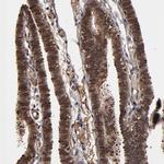 NXF2 Polyclonal Antibody